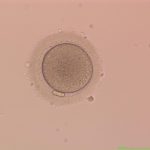 Mature Oocyte