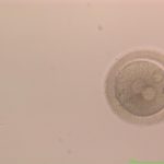 Day 1 2PN fertilized oocyte