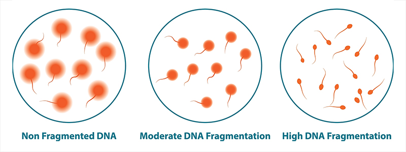 Sperm,Dna,Fragmentation,Test,Diagram