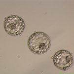 Day 5 Blastocyst