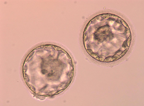 Blastocyst